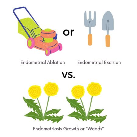 Image with analogy of treating endometriosis either mowing the weeds or digging the weeds up by the root.